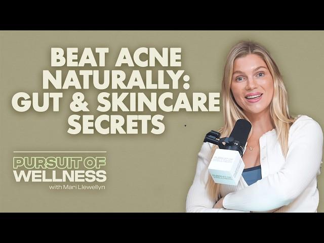 How I Healed My Acne: Gut Health, Treating H. Pylori & Skincare