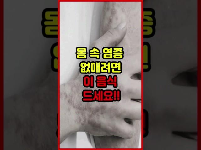 만성염증 없애려면 이 음식 드세요!! #염증 #만성염증 #만성염증에좋은음식