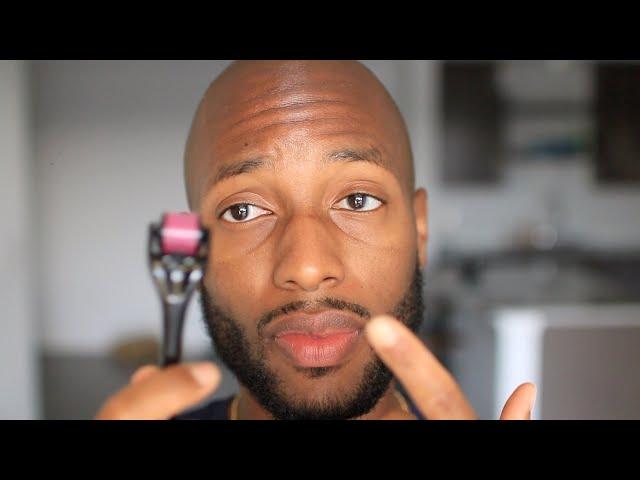 Complete Guide to Dermarollering/Microneedling for Beard Growth