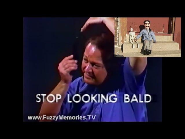 Stop Looking Bald Hair Spray!