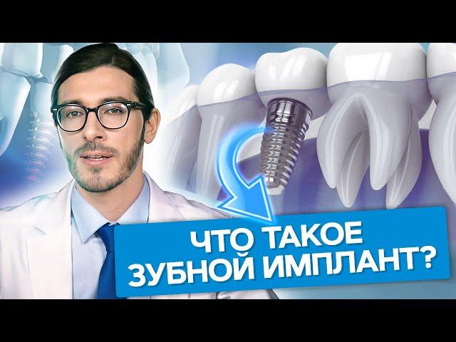 Что такое зубной имплант? Что же такое зубной имплант и из чего он состоит?