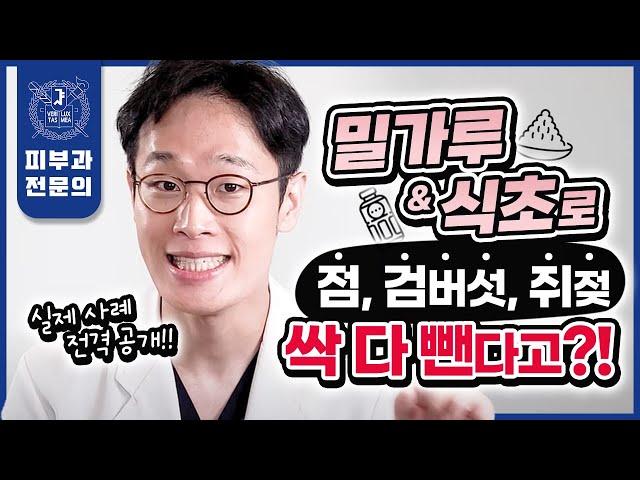 집에서 밀가루 식초로 점, 검버섯, 쥐젖 한번에 쏙 빼는 법 | 생생한 실제 경험담, 후기, 놀라운 효과까지 솔직하게 공개합니다! | 점제거 검버섯제거 쥐젖제거