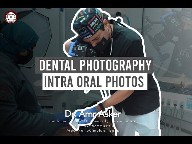 dental photography in relation to orthodontics part II intra oral photographs