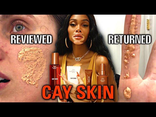 How Winnie Harlow DESTROYED My Face.  (The Cay Skin Disaster is Actually SO BAD)