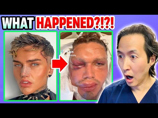 5 Plastic Surgeries on 1 Day That Went HORRIBLY Wrong!