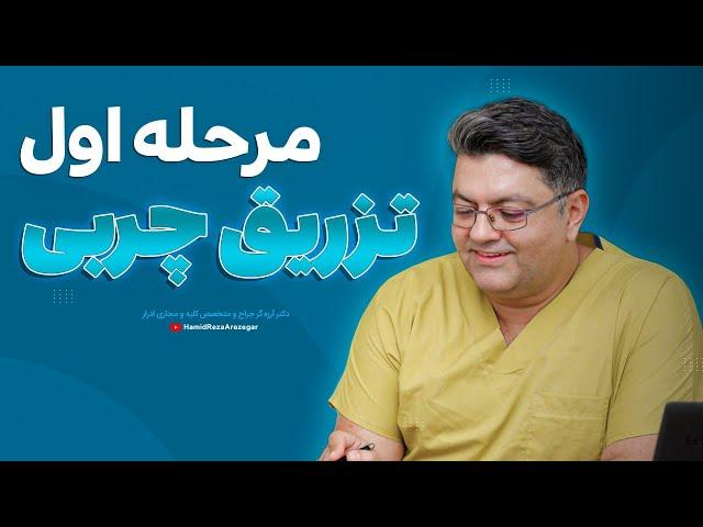 مرحله اول تزریق چربی