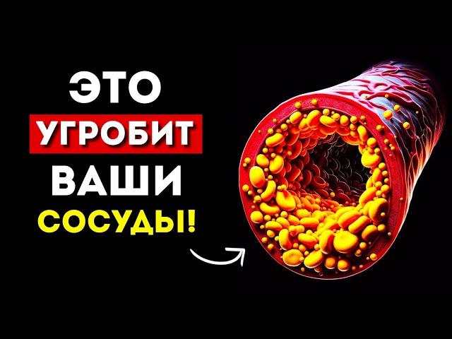 СОСУДЫ: 5 Самых вредных + 5 Самых полезных продуктов (Это нужно знать)