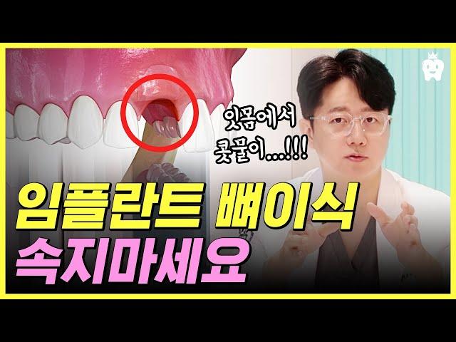 *제발 주의하세요!!* l 이 정보 모르고 치과 갔다간 남이 쓴 재활용 치조골 이식 받을지도 몰라요!!