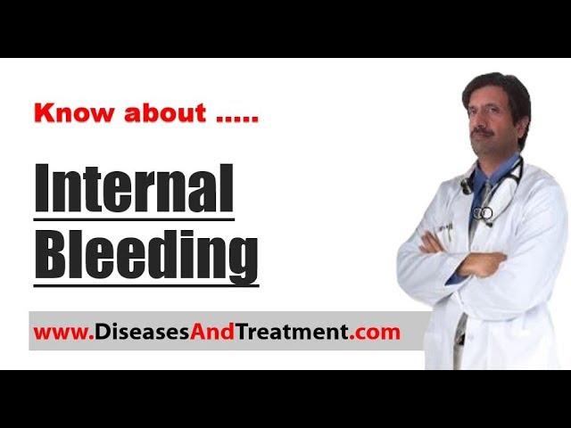 Internal bleeding (Internal Haemorrhage)  : Causes, Symptoms, Diagnosis, Treatment, Prevention