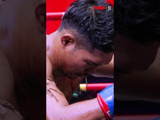 ELBOW DEFENCE TO OFFENCE!  Yothin shows us how the switch can happen in an instant!