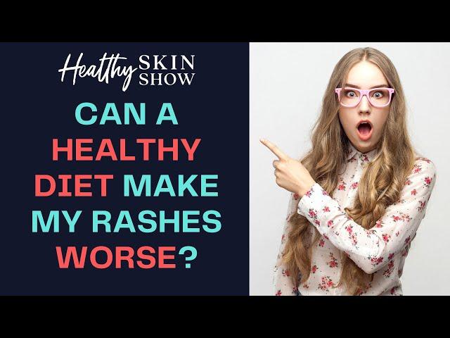 Can A Healthy Diet Change Make My Rashes WORSE?! | Jennifer Fugo