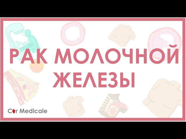 Рак молочной железы