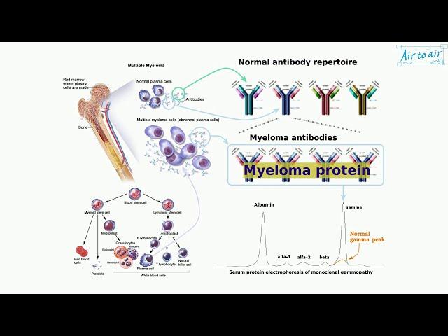 myeloma protein