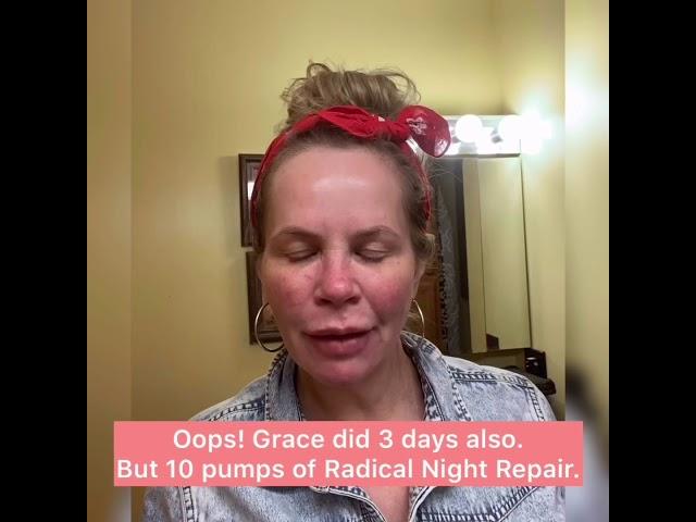 Lori Tries The ZO Home Peel Challenge