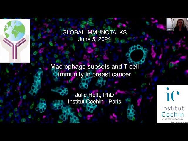 "Macrophage subsets and T cell immunity in Breast Cancer" by Dr. Julie Helft