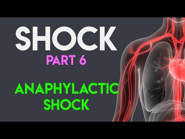 Anaphylactic Shock | Shock (Part 6)