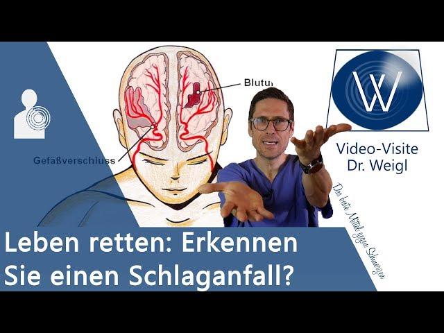 Schlaganfall: Erste Hilfe & Leben retten bei Hirnschlag! Risikofaktoren, Symptome & Therapie