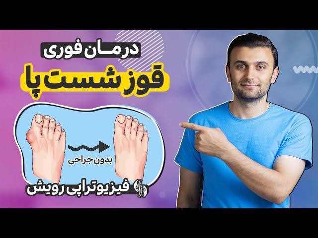 درمان قوز شست پا با 4 حرکت موثر خانگی