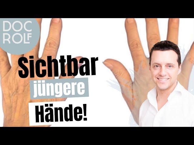 HANDVERJÜNGUNG mit Radiesse: Behandlung + vorher/nachher