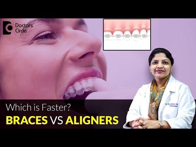 Invisible/ Clear Aligners vs Braces - Which is Faster? - Dr. Divyashree Rajendra | Doctors' Circle