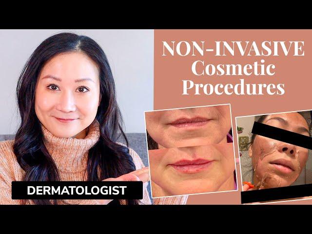 Dermatologist Explains NON INVASIVE Cosmetic Procedures | Botox, Fillers, Peels, Lasers, + MORE