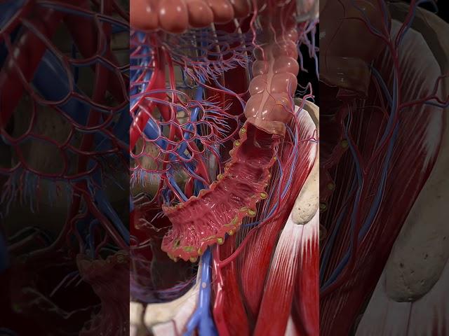 Diverticulitis 3d animation  #anatomy #3d