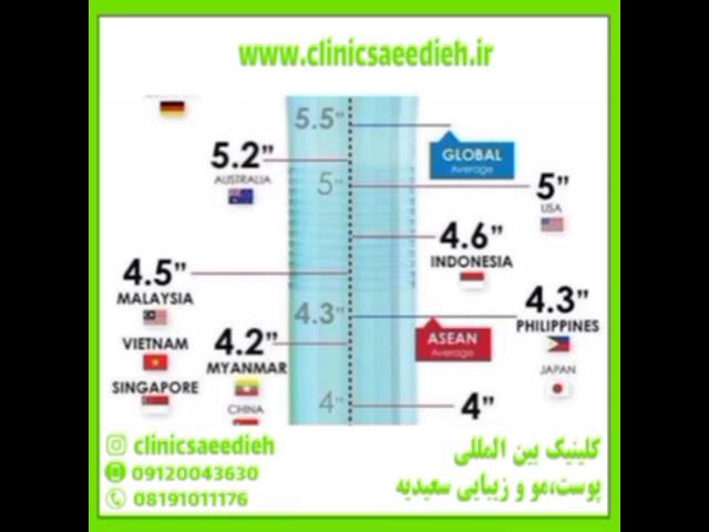 بهترین روش برای بزرگ و ضخیم کردن الت تناسلی