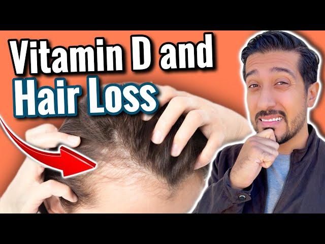 Vitamin D Deficiency HAIR LOSS | Is Vitamin D Hair Loss Reversible?