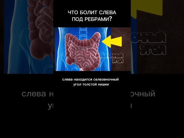 Что болит СЛЕВА под ребрами? #боль #гастроэнтеролог