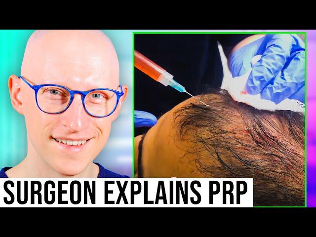 PRP For Hair Regrowth