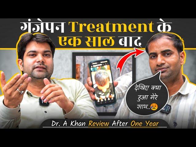 "एक साल पहले Hair Locking कराया था और आज.." | Dr A Khan | Review After 1 Year