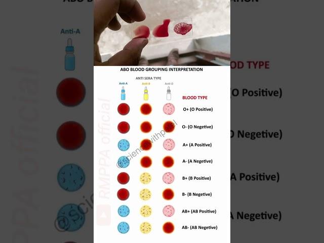 #shorts #video Blood group dekhe kainsa group hai