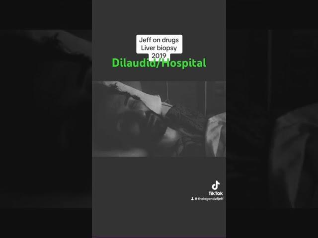 Dilaudid after Biopsy