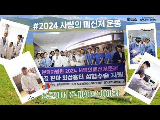 분당차병원 2024 사랑의 메신저 운동 몽골에서 화상흉터 치료를 위해 찾아온 바야르의 이야기