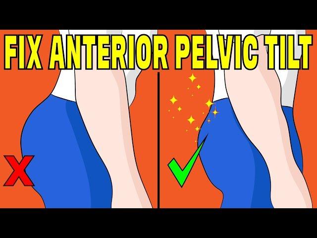How to fix anterior pelvic tilt without any equipment - The Natural Method