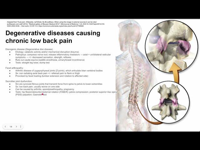 Degenerative diseases causing chronic low back pain