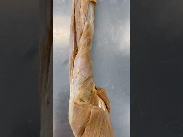 Did You Know This Muscle Existed? Supinator | Institute of Human Anatomy