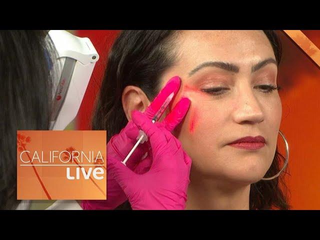 What is Baby Botox? Dr. Tess Explains | California Live