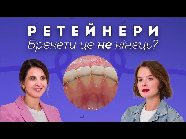 Ретейнери. Все про період закріплення результатів після брекетів | Stoma Talk