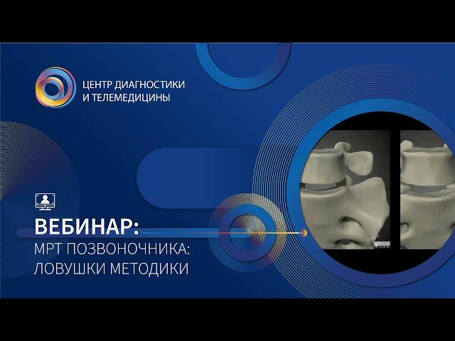 МРТ позвоночника:  ловушки методики