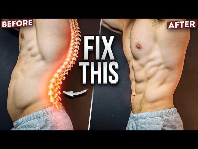 FIX LOWER BACK. BEFORE IT’S IRREVERSIBLE