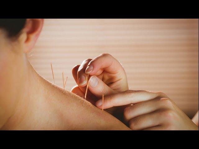 Expert with 10 Years Experience Shares Top Acupuncture Tips