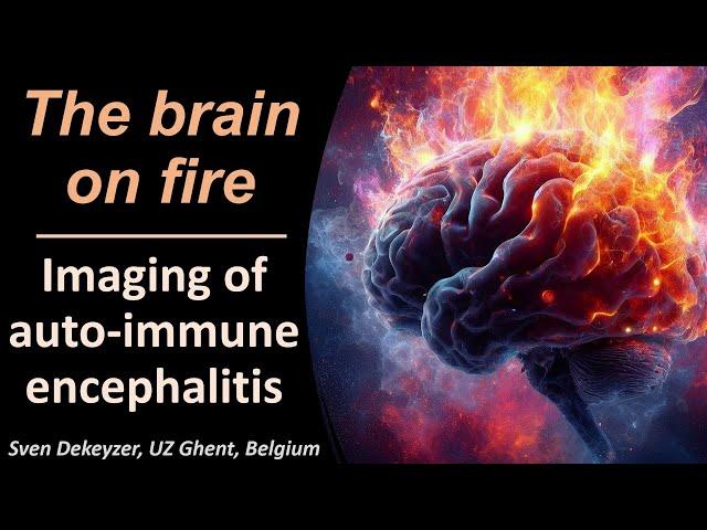 Imaging of Auto-immune Encephalitis