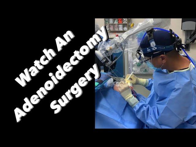 Adenoidectomy - actual footage