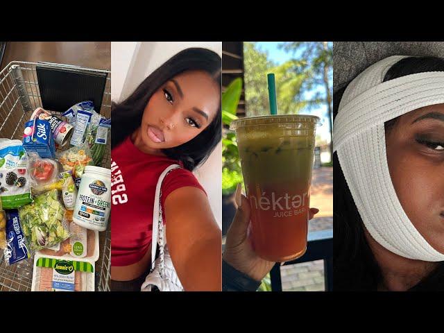 VLOG: Days in My Life, Mall Run, Juice Bar, Getting Kybella, Back To Healthier Habits & more