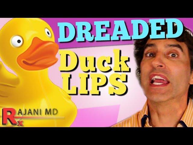 DUCK LIPS - Lip Fillers Gone Wrong