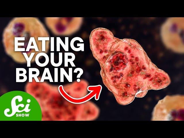 Terrifying Parasites Inside the Human Body