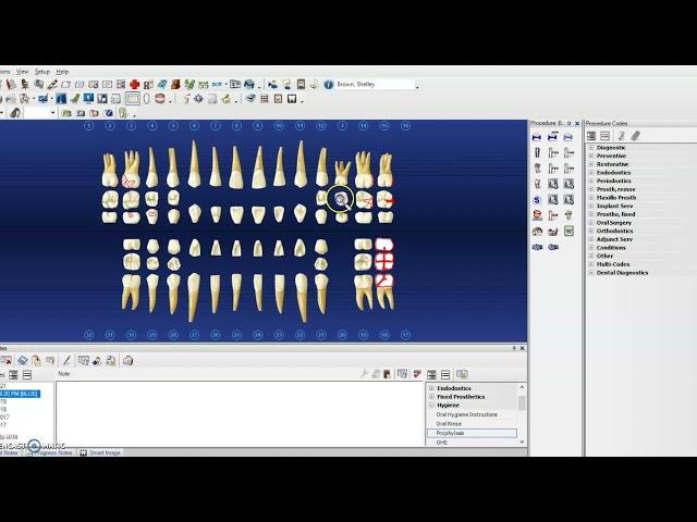 Hard Tissue Charting on Dentrix