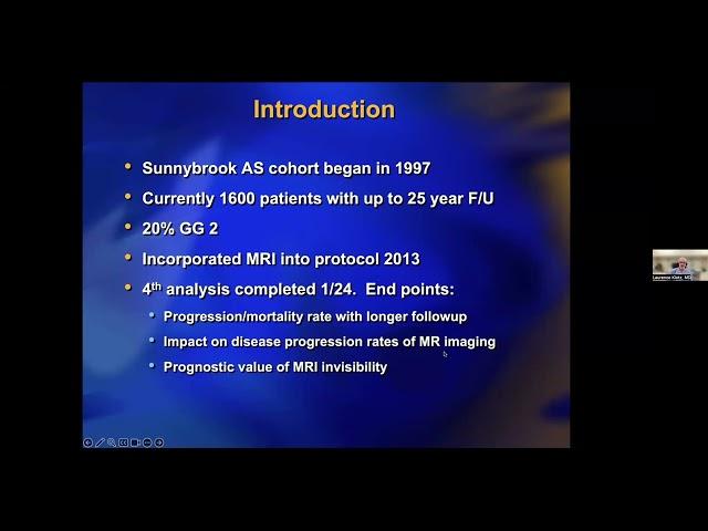 Webinar: Is Pre-treatment Active Surveillance for Prostate Cancer Safe? 04/29/24