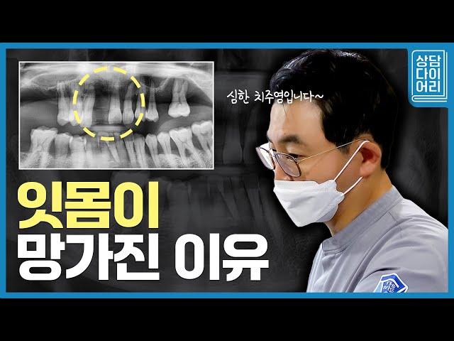 남들에 비해 잇몸이 빨리 망가지는 이유